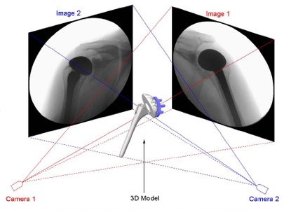 Biomechanics Figure 14 Virtual DFIS recreated in computer space from the geometry of the actual fluoroscopic system, shown with CAD models of total shoulder arthroplasty.