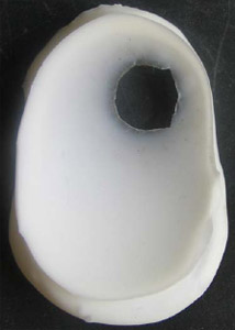 Biomechanics Figure 17 Silicon rubber impression.