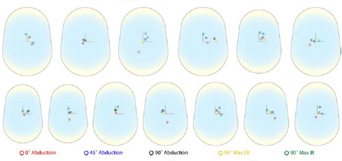 Biomechanics Figure 24 Unscaled patient humeral head center locations on the glenoid surface as a function of arm position, shown by color code. All right shoulder humeral head centers locations were mirrored to left glenoid components.