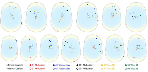 Biomechanics Figure 25 Unscaled patient specific glenoid contact locations and humeral head center locations on the glenoid articular surface as a function of arm position, shown by color code. All right shoulder locations were mirrored to left glenoid components.