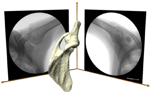 Biomechanics Figure 32 Virtual DFIS created in computer space from the actual geometry of the fluoroscopes shown with 3D model of the scapula and humerus.
