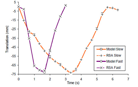 Biomechanics Figure 34 Scapula protraction/retraction translation as a function of cycle time in approximately the coronal plane.