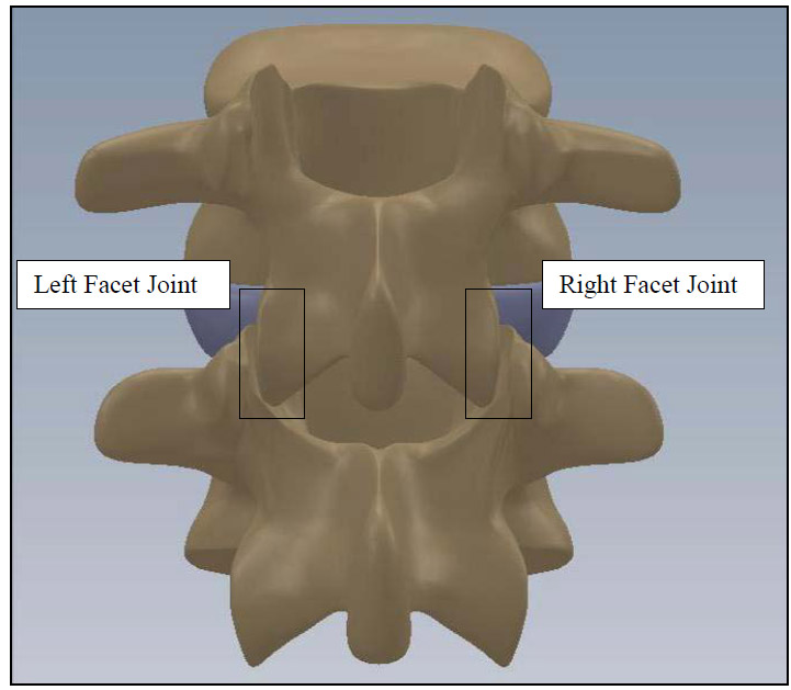 Figure 2: FSU Rear Coronal View fig 2