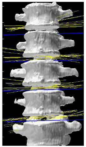 Figure 21: Helical Axes During Flexion/extension fig 21