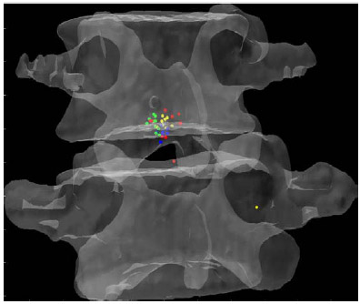 Figure 23: Mean HAM Intersections during Lateral Bending fig 23