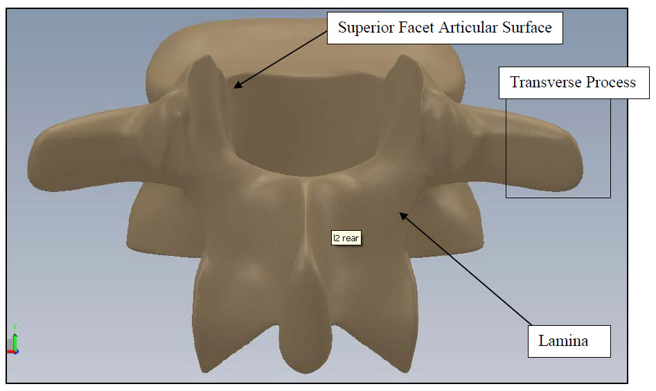 Figure 3: Vertebral Body Rear View fig 3