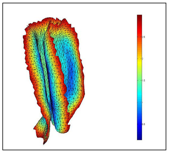 Figure 33: Left ROI for Single FSU fig 33