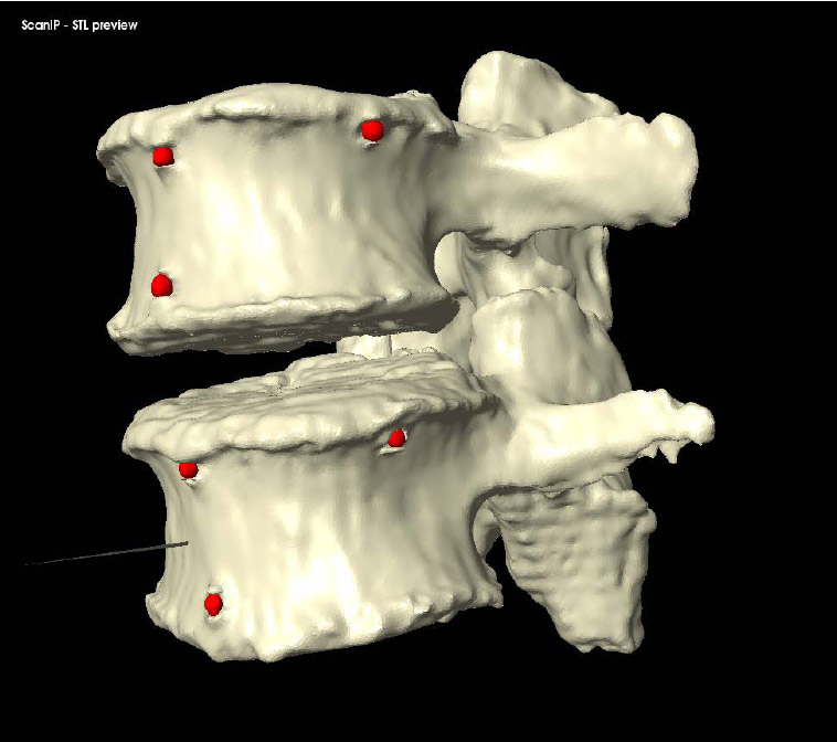 Figure 37: Fiducial Segmentation fig 37
