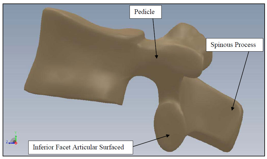 Figure 4: Vertebral Body Sagittal View fig 4