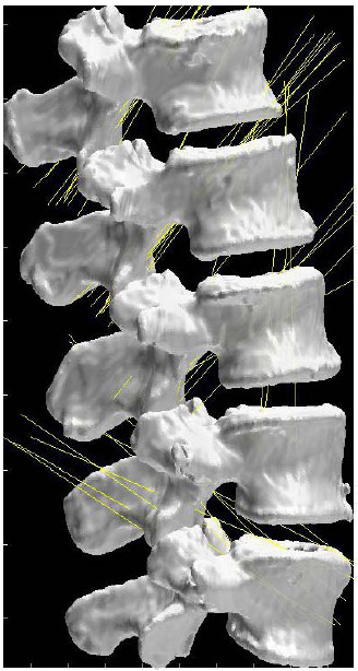 Figure 41: HAMs during Axial Torsion fig 41