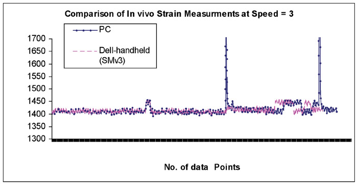 Figure 13. This recording shows two artifacts caused by the slipping of the power coil from the transmitter. figure 13
