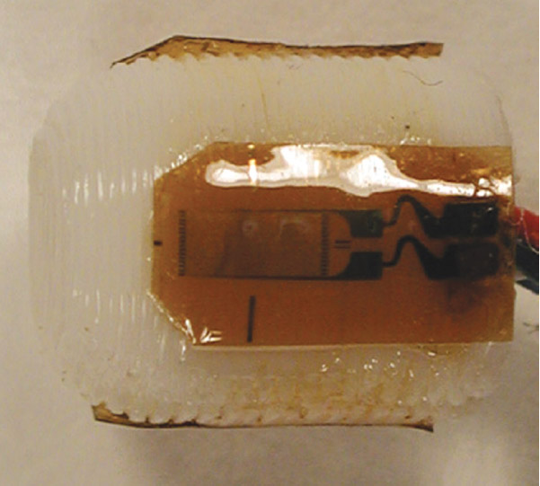 Figure 4. An implantable scaffold with one uniaxial strain gauge showing. figure 4