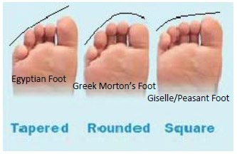 Podiatry Figure 2. This displays the different foot shapes. It compares toe length with foot width.