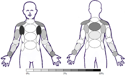 Sample: GS1 � Garment Softened 1 time - Activity: Toe Touches and Arm Raises Sample: GS1 � Garment Softened 1 time - Activity: Toe Touches and Arm Raises