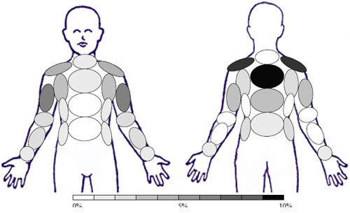 Sample: GC � No Treatment - Activity: Cross Body Arm Movements Sample: GC � No Treatment - Activity: Cross Body Arm Movements
