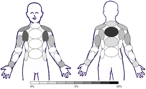 Sample: GC � No Treatment - Activity: Toe Touches and Arm Raises Sample: GC � No Treatment - Activity: Toe Touches and Arm Raises