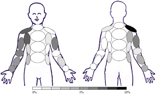 Sample: GC � No Treatment - Activity: Bowling Sample: GC � No Treatment - Activity: Bowling