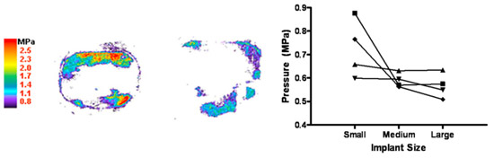 Fig. 5. Pressure film results. (Left) Representative small and large implant. (Right) Changes in average pressure with implant size. pressure film results
