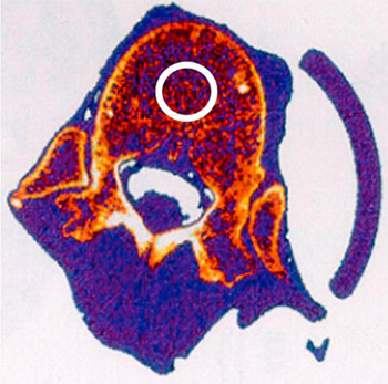 Fig. 2. Representative peripheral quantitative computed tomography scan
of vertebral specimen. A 10-mm diameter circular region of interest of
trabecular bone was evaluated for each specimen to determine bone
density. tomography scan