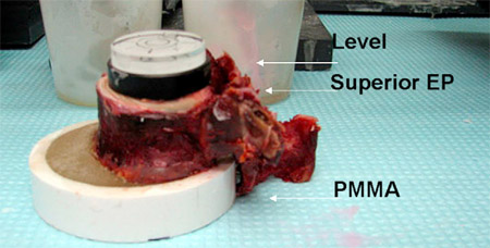 Fig. 3. Vertebral bodies were dissected and potted in polymethylmethacrylate
using a level to keep the end plate surface flat. Vertebral bodies