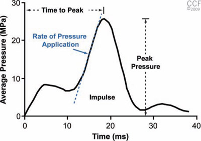 Figure 2. Typical profile showing the impact of a 25-MPa impact specimen. Values obtained from the curve were time to peak, peak pressure, rate of pressure application, and impulse (area under the curve). Reprinted with permission, Cleveland Clinic Center for Medical Art & Photography © 2009-2010. All rights reserved. Profile showing impact