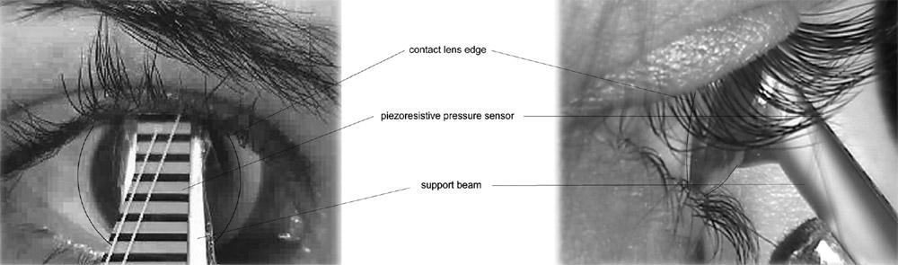 FIGURE 1. Front view <i>(top left)</i> and side view (<i>top right)</i> of an eyelid pressure measurement using a pressure sensor mounted on a specially designed rigid contact lens with plastic support beam. Schematic of sensor-contact lens combination <i>(lower)</i> with R (back surface radius of curvature) and D (diameter). All curves are spherical with an asphericity of 0 unless otherwise stated. front and side view of eyelid presure