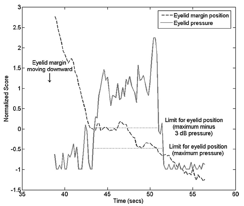 FIGURE 3. Normalized values for eyelid pressure measurement normalized values
