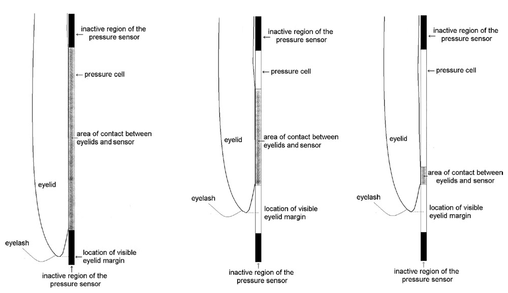Possible models of eyelid contact with the pressure cell. Possible models of eyelid contact