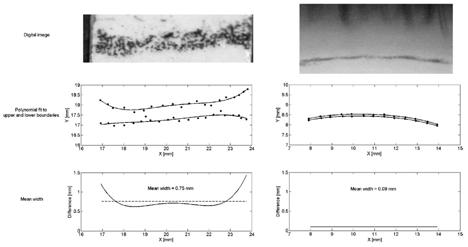 Examples of the digital images (top) and analysis (middle and lower) of a contact imprint width digital images and analysis