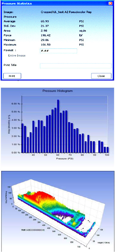 Figure 7. : Software statistic, histogram and 3D reconstruction software output