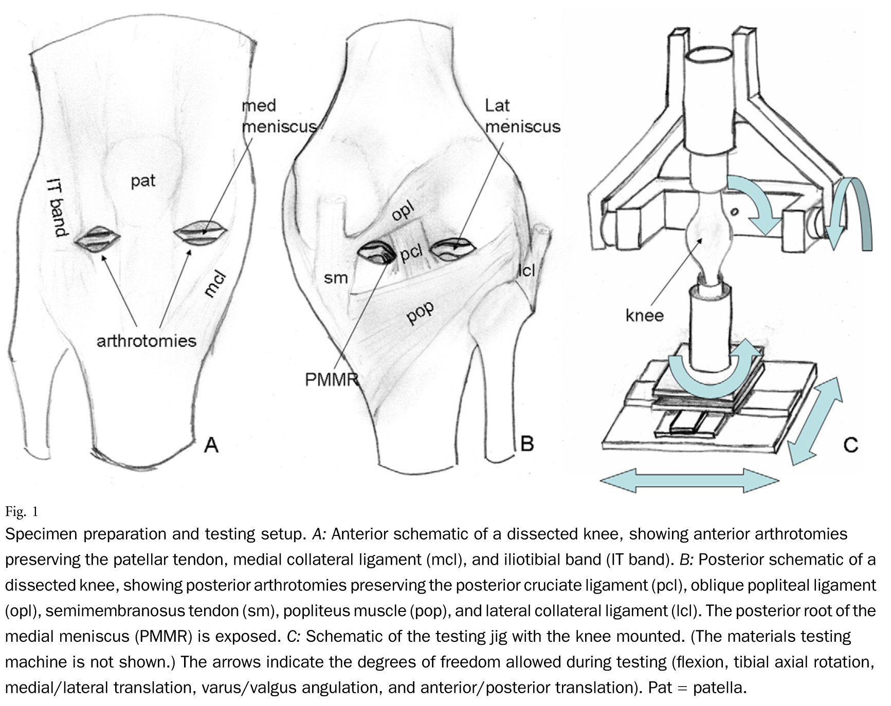 Anterior-schematic-of-a-dissected-knee