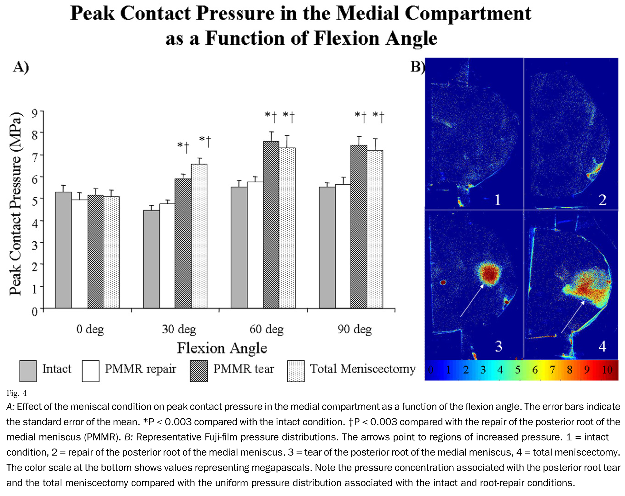 Effect-of-the-meniscal-condition