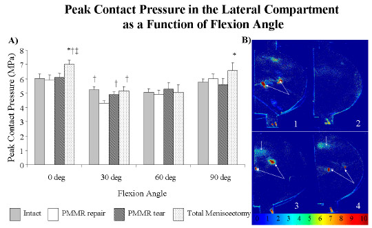 Peak Contact Area in the Lateral Compartment as a Function of Flexion Angle
